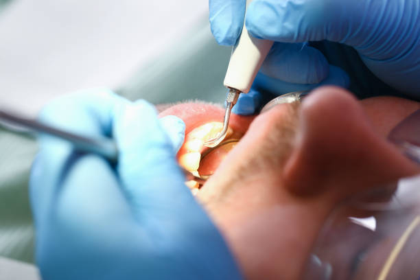 Best Emergency Treatment for Toothache in Felida, WA